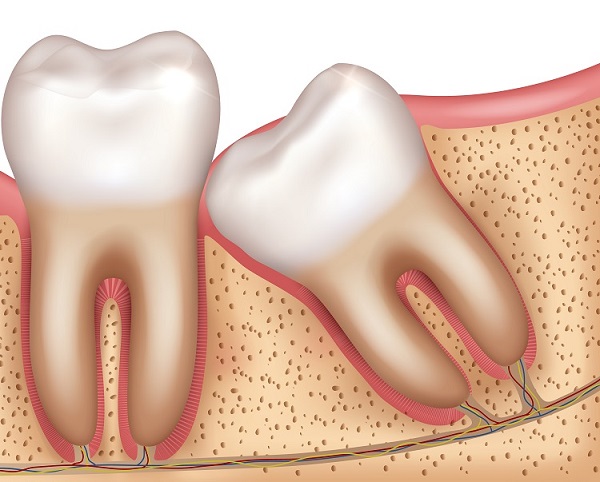 Denti del giudizio