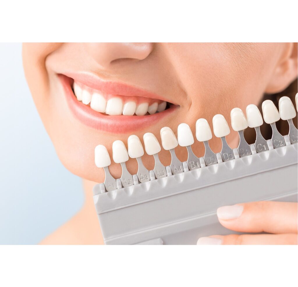 Teeth Whitening