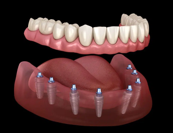 a model of human teeth