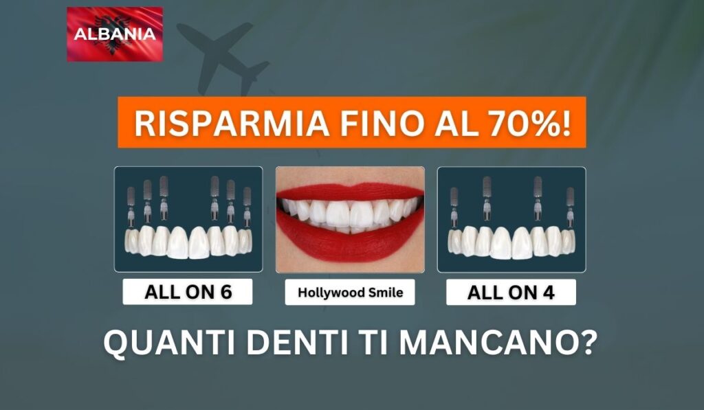 impianti dentali