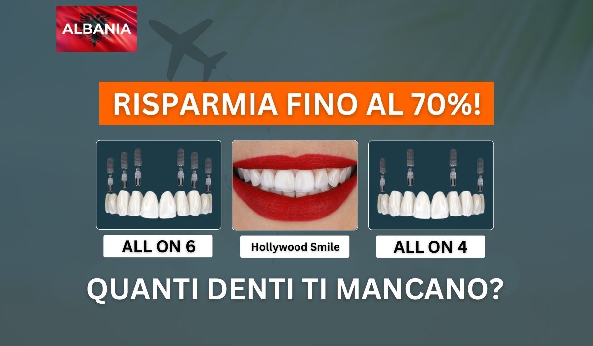 impianti dentali